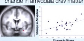 Meditation Can Reshape Our Brains