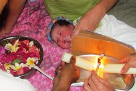 Newborn baby's umbilical cord being burned off