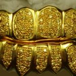Gold teeth
