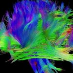 Neural circuits in human brain Feat.