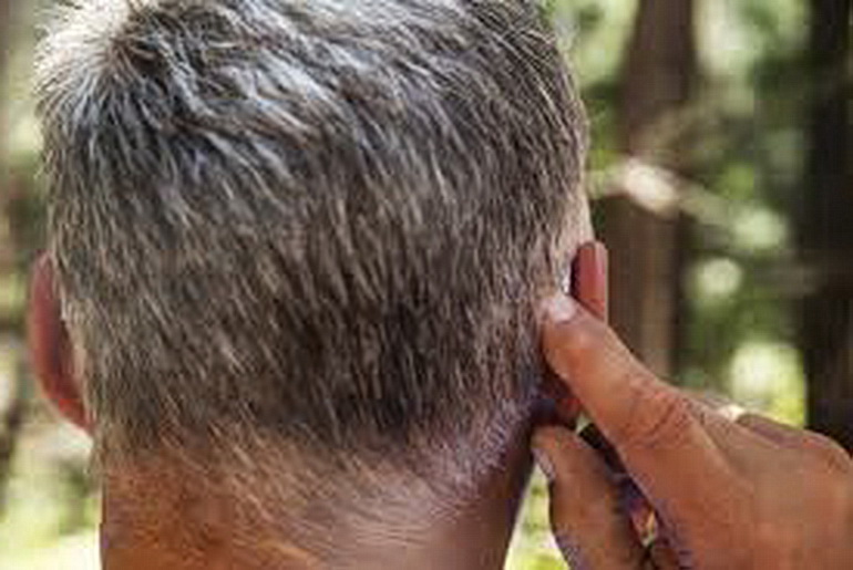 Hearing aid