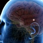 Location of pineal gland in the brain