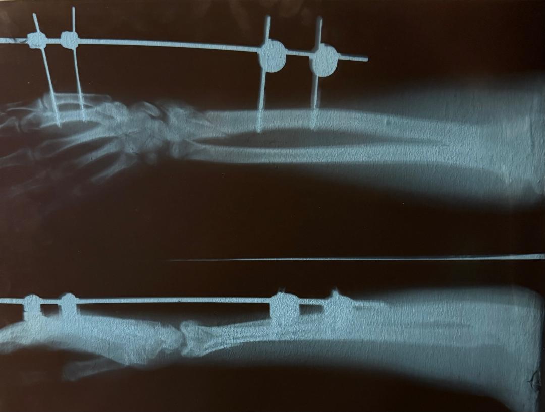 X-ray